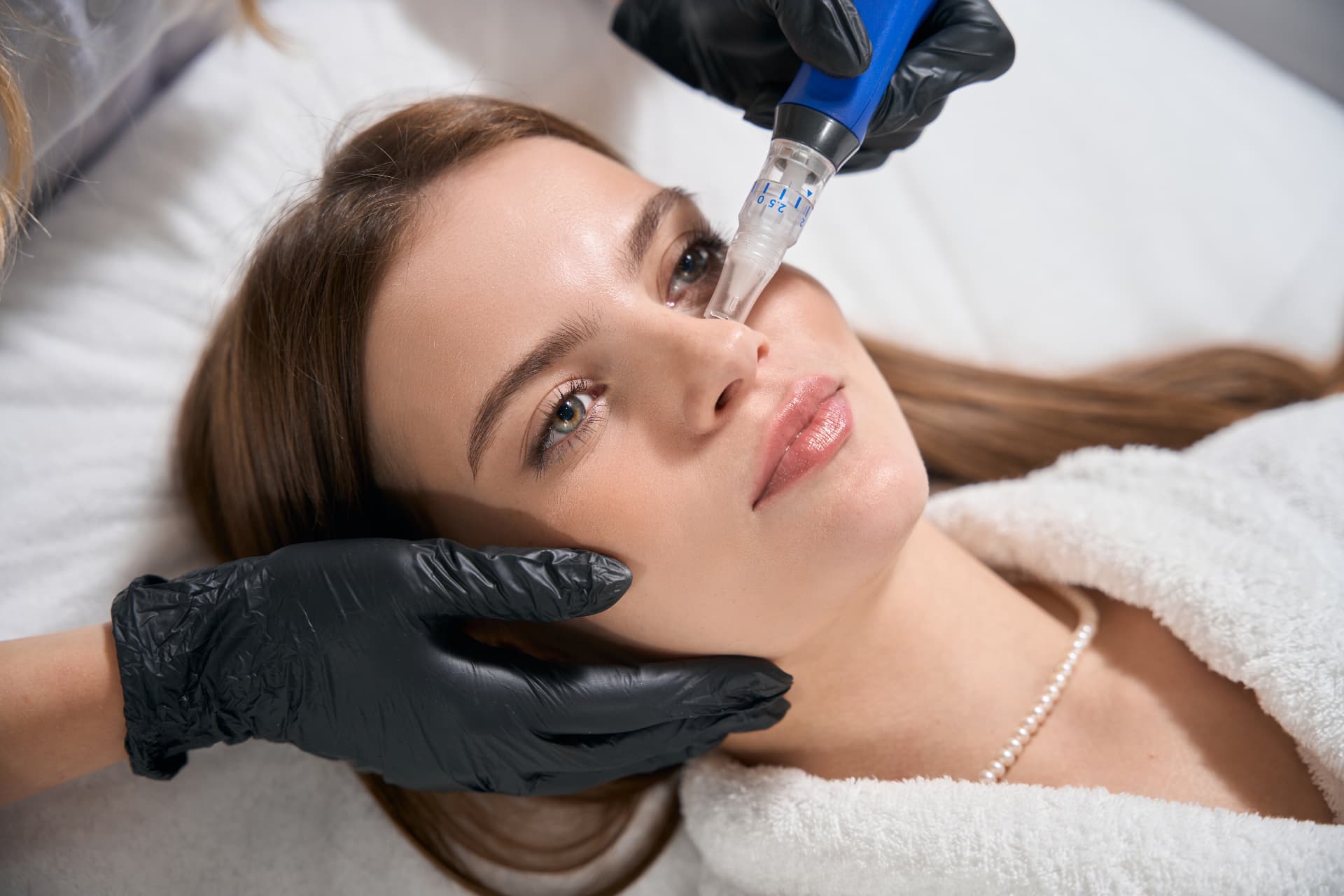 SkinPen Microneedling im Charisma Beautycenter